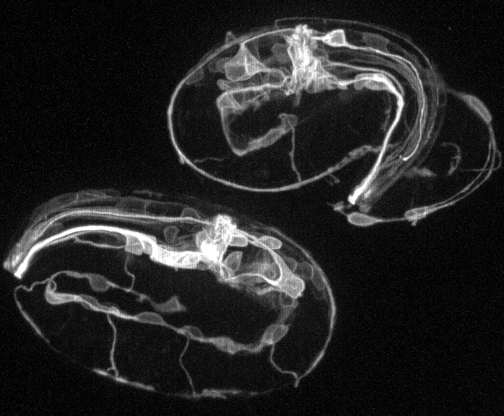 Confocal imaging of neuronal process outgrowth in C. elegans embryos (Pavak Shah)